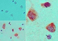 Polyclonal Rabbit anti-Human S1PR1 / EDG1 / S1P1 Antibody (aa1-50, IHC)