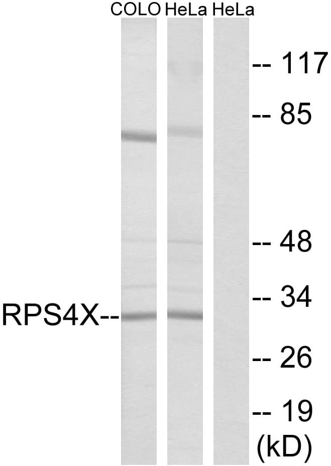 IHC-plus™ Polyclonal Rabbit anti-Human RPS4X + RPS4Y1 + RPS Antibody (aa81-130, IHC, IF, WB)