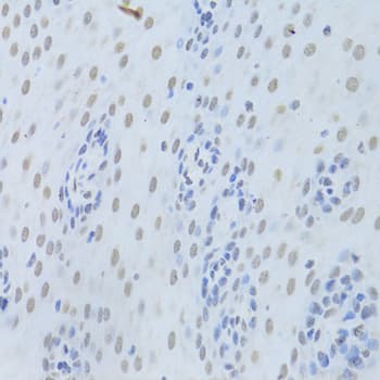 Polyclonal Rabbit anti-Human HNRNPK / hnRNP K Antibody (IHC, IF, WB)