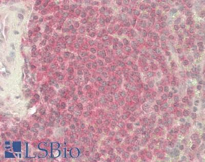 IHC-plus™ Monoclonal Mouse-Balb/c anti-Human DGKA Antibody (clone M6, IHC, WB)
