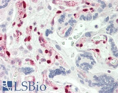 IHC-plus™ Polyclonal Rabbit anti-Human Glucocorticoid Receptor Beta Antibody (N-Terminus, IHC, WB)