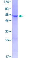 Human TMIGD1 Protein (Recombinant GST)
