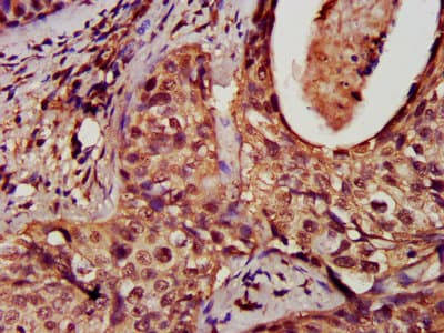 DNM1L / DRP1 Antibody