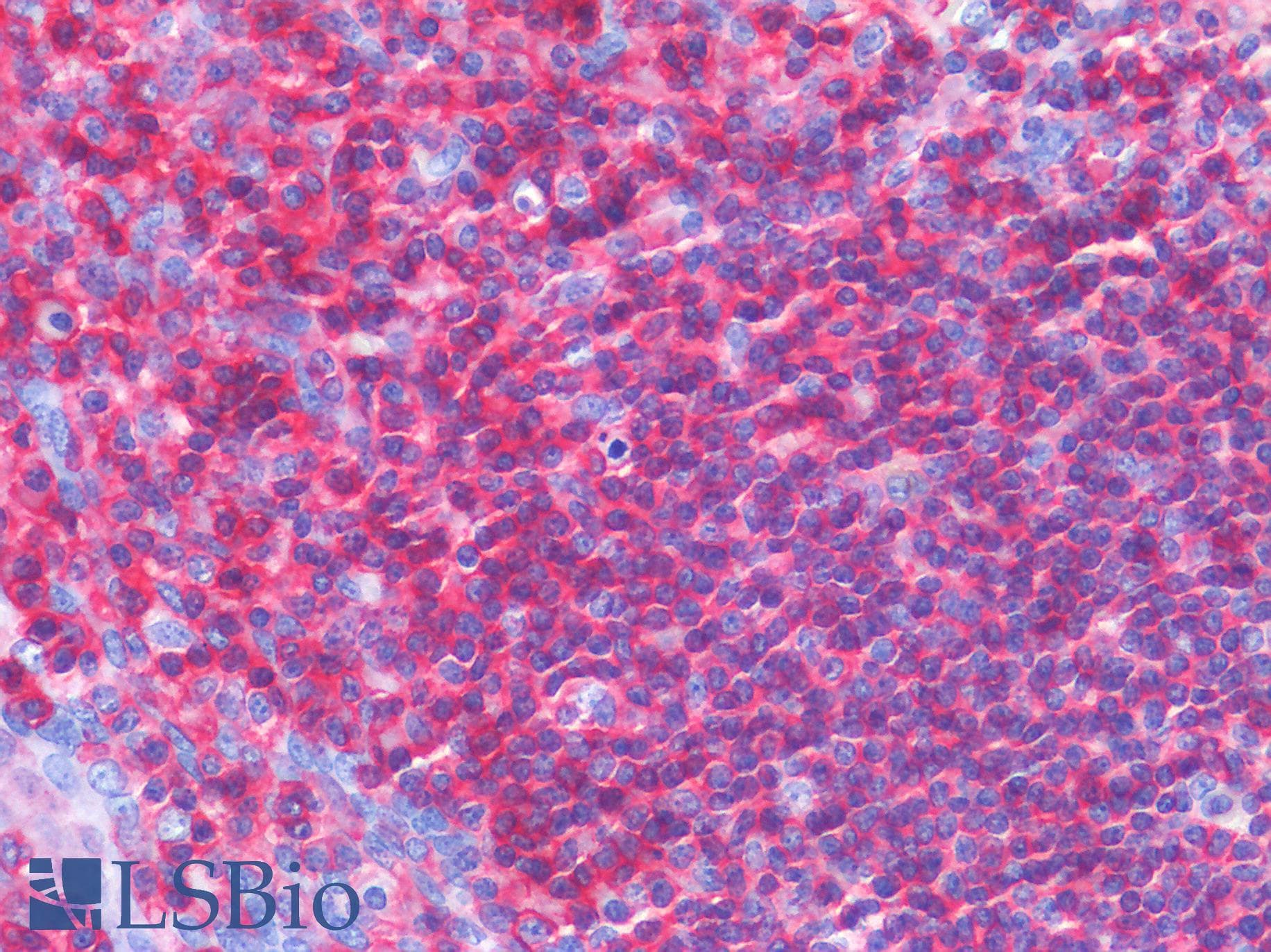 IHC-plus™ Polyclonal Rabbit anti-Human CD45 / LCA Antibody (IHC)