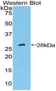 PTCH1 / Patched 1 Antibody (aa227-436)