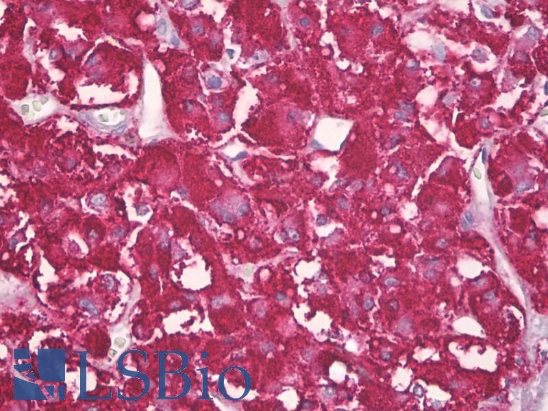 IHC-plus™ Polyclonal Rabbit anti-Human FE65L1 / APBB2 Antibody (aa471-520, IHC, WB)