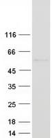 Human HYAL1 Protein (Recombinant Myc-DDK (Flag))