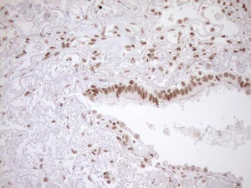 EXOSC1 / CSL4 Antibody (clone OTI1H9)