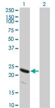 IHC-plus™ Monoclonal Mouse anti-Human HSPB8 / H11 / HSP22 Antibody (clone 5B12, IHC, WB)