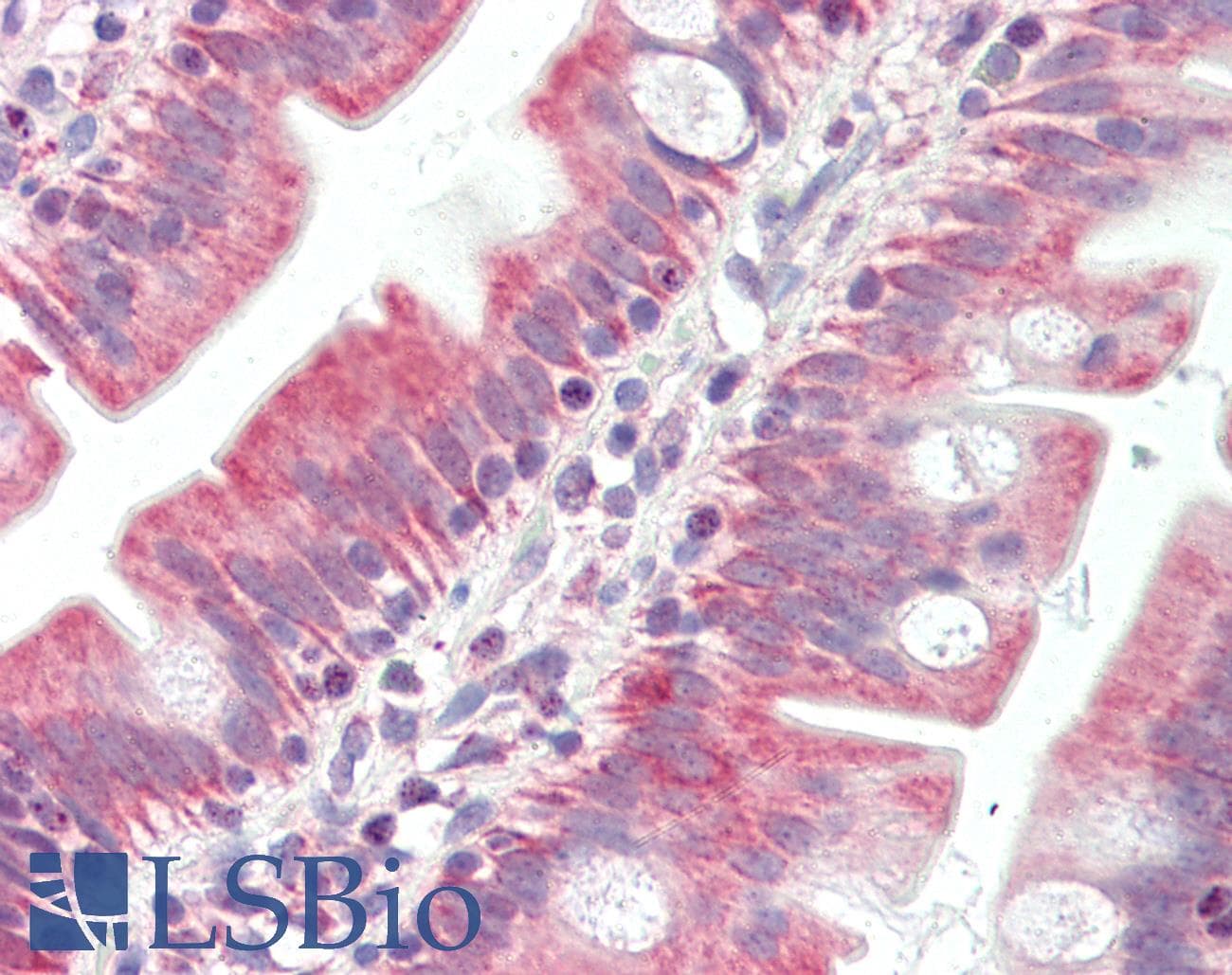 IHC-plus™ Polyclonal Rabbit anti-Human BAK1 / BAK Antibody (IHC, IF, WB)