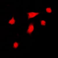 DGK-IOTA / DGKI Antibody (C-Terminus)