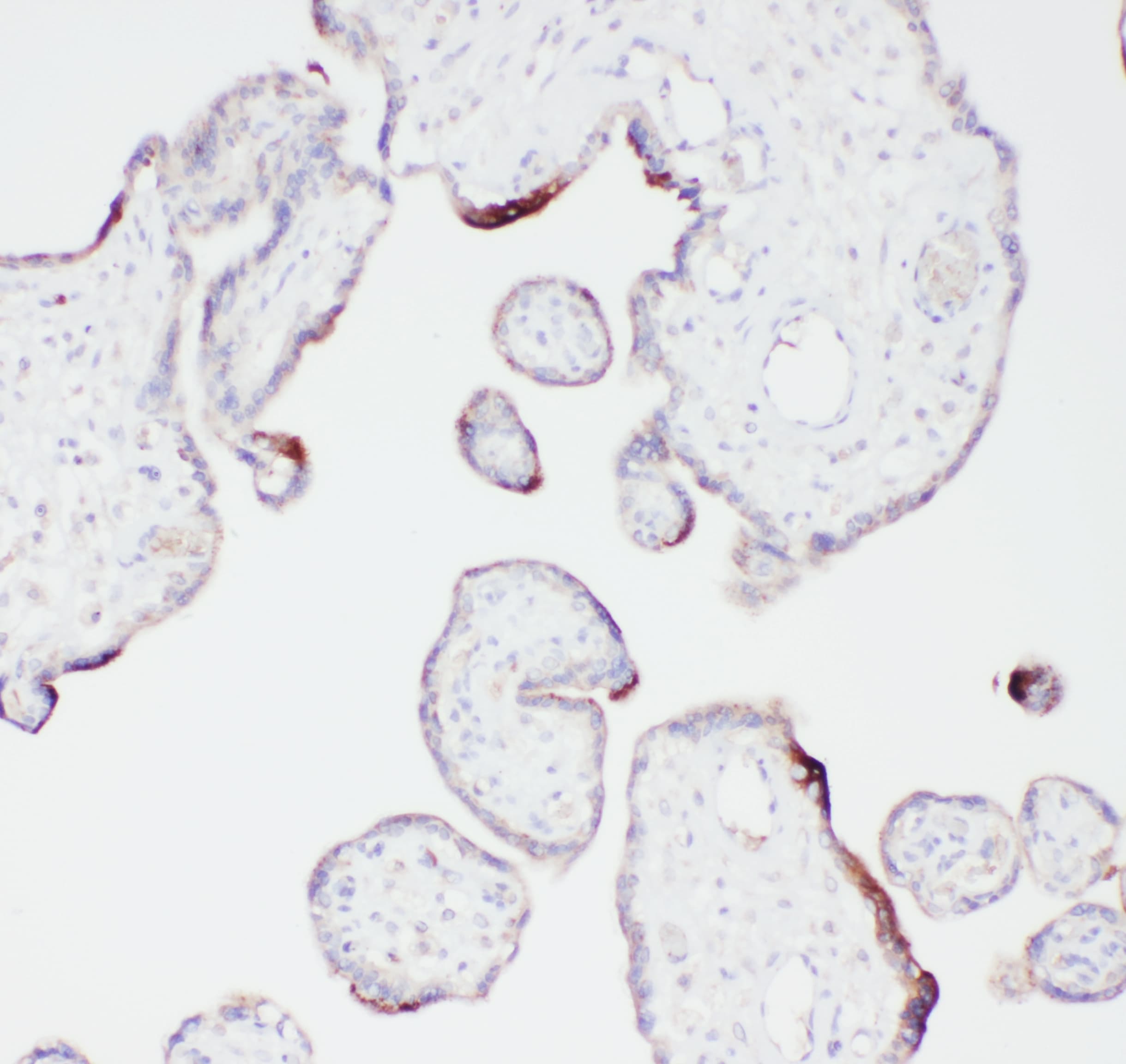PLG / Plasmin / Plasminogen Antibody (aa103-352)