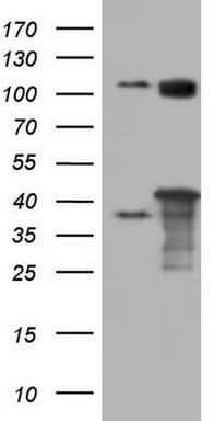 PPP1R8 / Rnase E Antibody (aa1-225, clone OTI4D5)