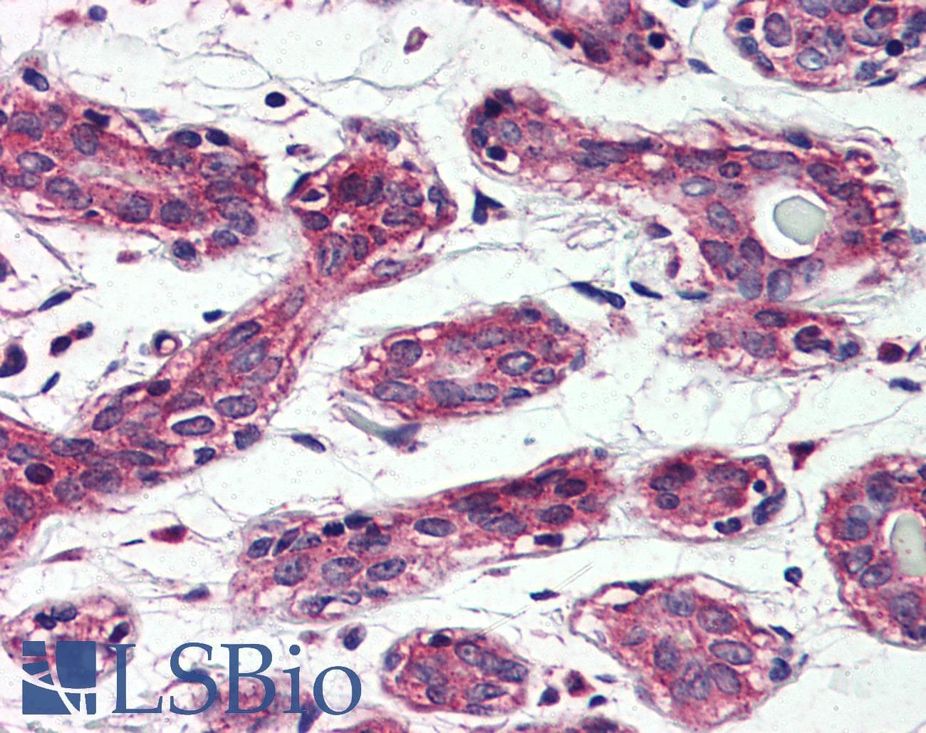 IHC-plus™ TAOK1 / TAO1 Antibody (Internal)