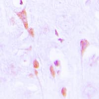 ARRB1 / Beta Arrestin 1 Antibody (phospho-Ser412)