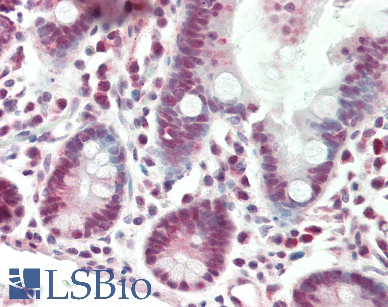 IHC-plus™ SMAD7 Antibody (aa49-317)