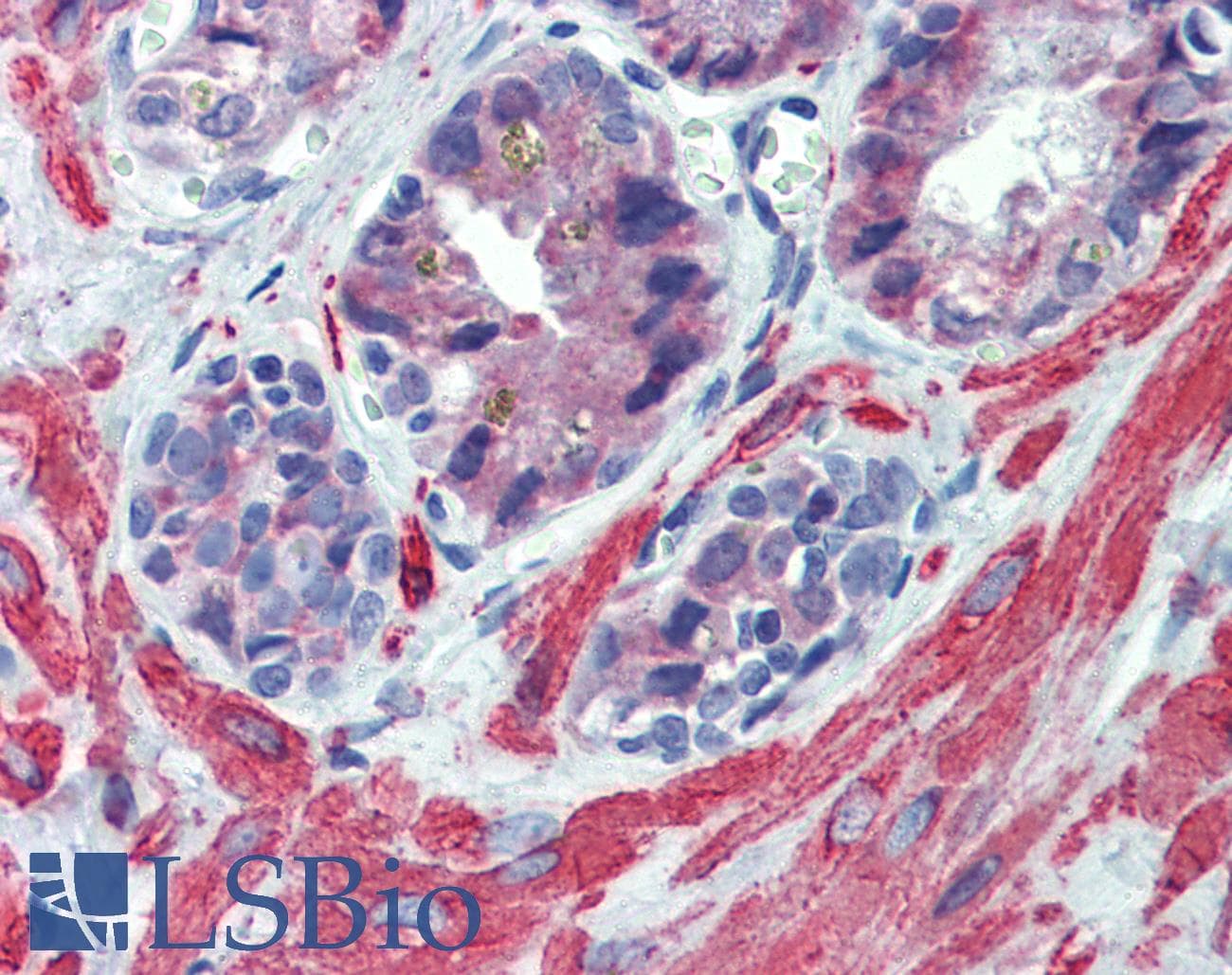 IGFBP4 Antibody (aa180-229)
