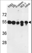 PPM1H Antibody (aa235-263)