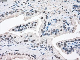 Monoclonal Mouse anti-Human SSB / La Antibody (clone OTI3F11, IHC, IF, WB)