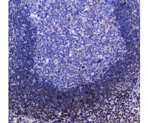 INPP5D / SHIP1 / SHIP Antibody