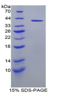 Bovine IGF1 Protein (Recombinant His-GST)