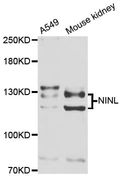 Polyclonal Rabbit anti-Human NINL Antibody (WB)