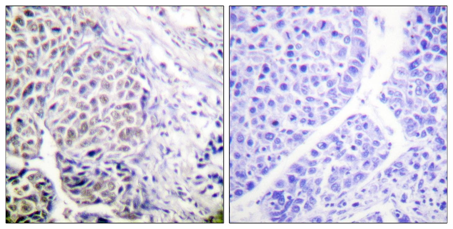 Polyclonal Rabbit anti-Human AURKB / Aurora-B Antibody (phospho-Tyr12, IHC, WB)