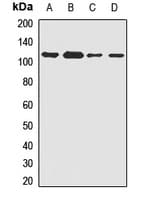 Polyclonal Rabbit anti-Human PLK4 / SAK Antibody (WB)