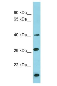 Polyclonal Rabbit anti-Human BRICD5 Antibody (aa6-55, WB)