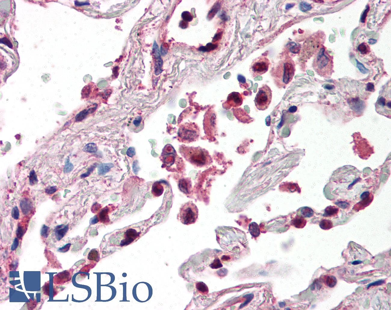 IHC-plus™ Polyclonal Rabbit anti-Human TLR8 Antibody (Internal, IHC, WB)