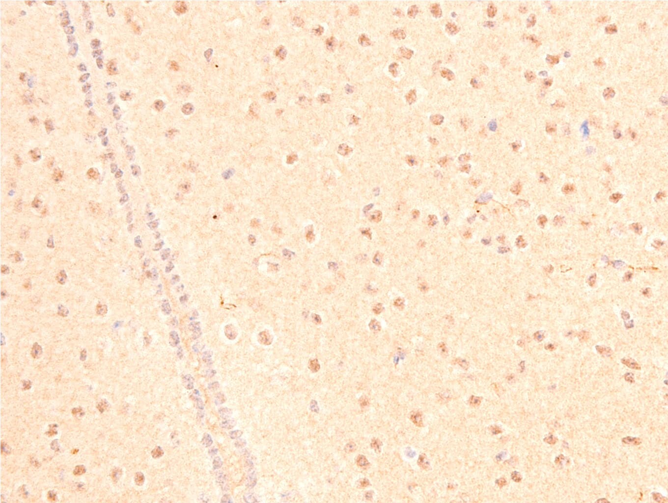 TP53 / p53 Antibody (Acetyl-Lys317)
