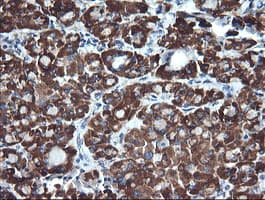 IHC-plus™ ACAA2 Antibody (clone 1C10)