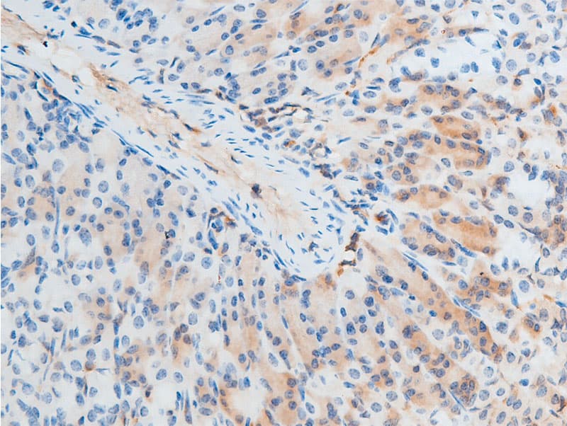 CHEK2 / CHK2 Antibody (phospho-Thr387)