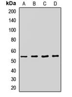Polyclonal Rabbit anti-Human ATG14 Antibody (WB)