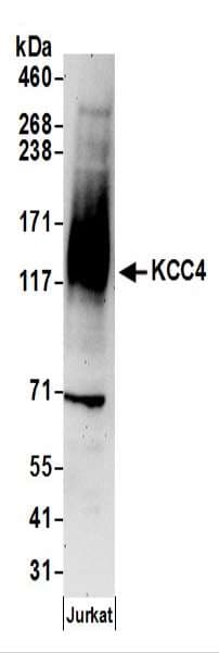 SLC12A7 / KCC4 Antibody (aa950-1000)