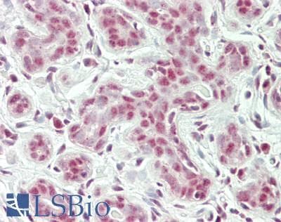 IHC-plus™ RBM26 / SE70 Antibody (aa200-250)