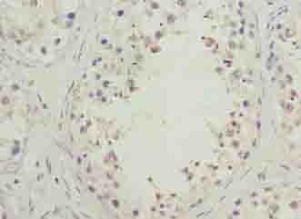 Polyclonal Rabbit anti-Human SPACA1 Antibody (IHC)