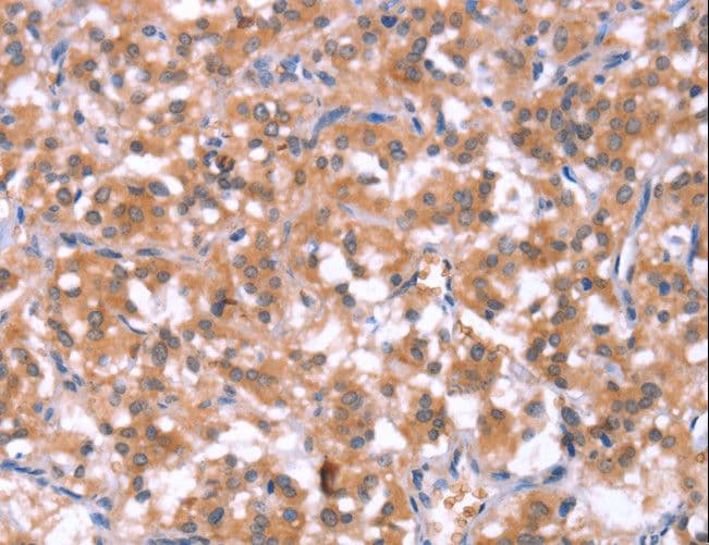 HCAR2 / NIACR1 Antibody