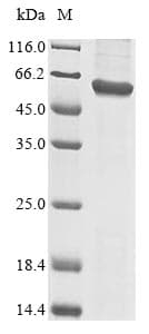 Human TRAIP / TRIP Protein (Recombinant 10His, N-terminus)