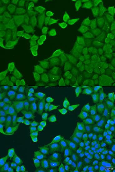 Polyclonal Rabbit anti-Human ARF3 Antibody (IF)
