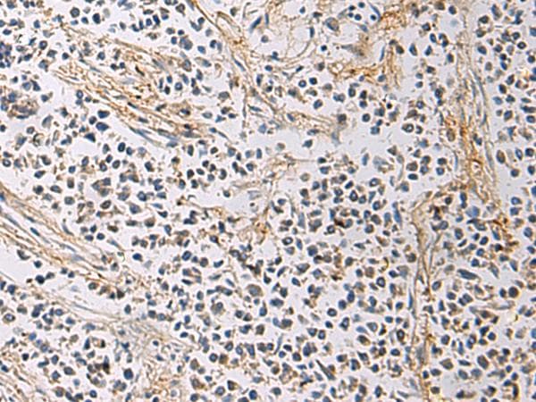 GMPR1 / GMPR Antibody