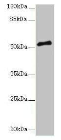 Polyclonal Rabbit anti-Human PLXNA4 / Plexin A4 Antibody (WB)