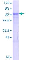 Human MRM1 Protein (Recombinant GST)