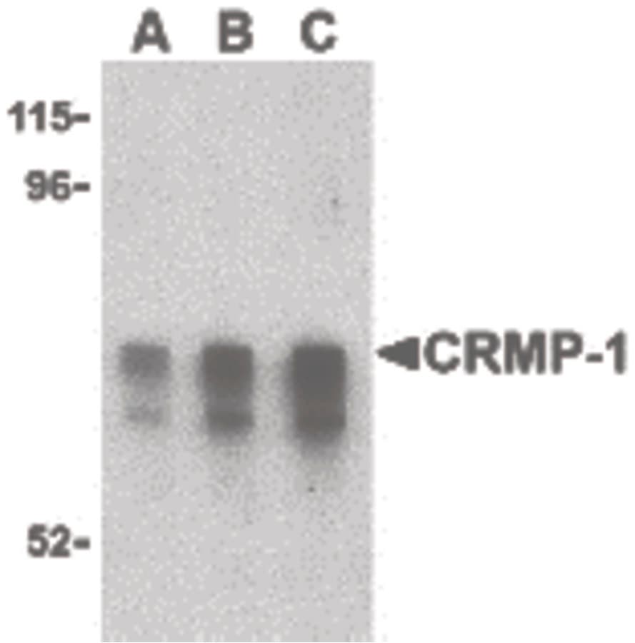 Polyclonal Rabbit anti-Human CRMP1 Antibody (IHC, IF, WB)