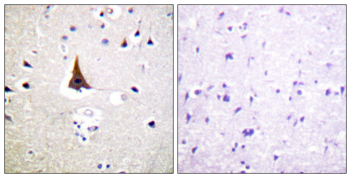 Polyclonal Rabbit anti-Human VAV2 Antibody (aa108-157, IHC, IF, WB)