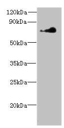 NEK11 Antibody