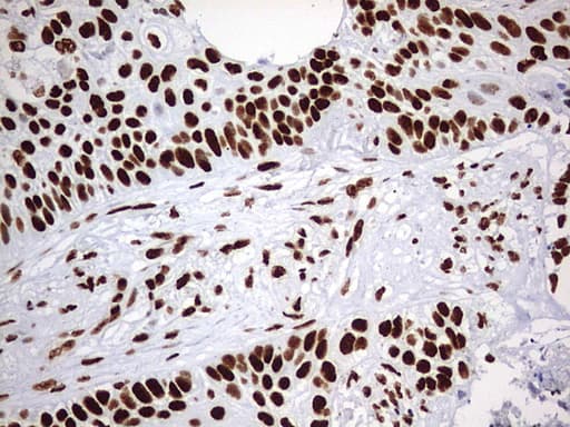 Monoclonal Mouse anti-Human HNRPM / HNRNPM Antibody (clone OTI1F6, aa1-261, IHC, WB)