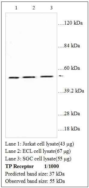 Thromboxane A2 Receptor Antibody