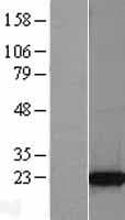 TPT1 / TCTP Protein (Over-Expression Lysate Myc-DDK (Flag))