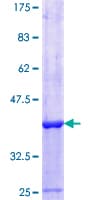 Human PARP13 / ZC3HAV1 Protein (Recombinant GST, N-terminus)